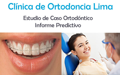 ortodoncia-lima-2