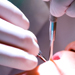 ortodoncia-lima-curaciones